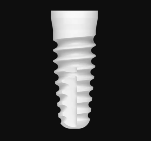 ceramic dental implants